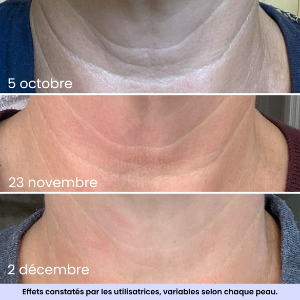 Crème liftante